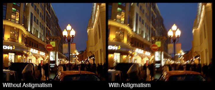 Astigmatism